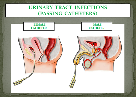 can male sperm cause uti in females