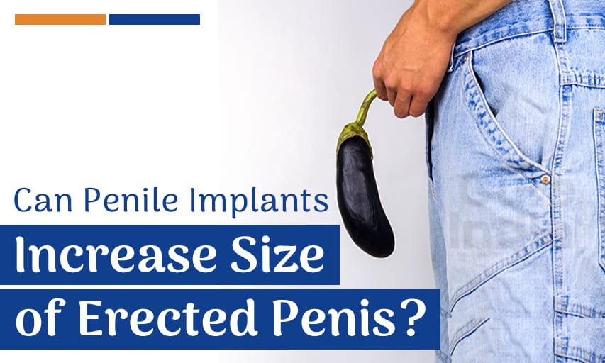 can penile implants increase size