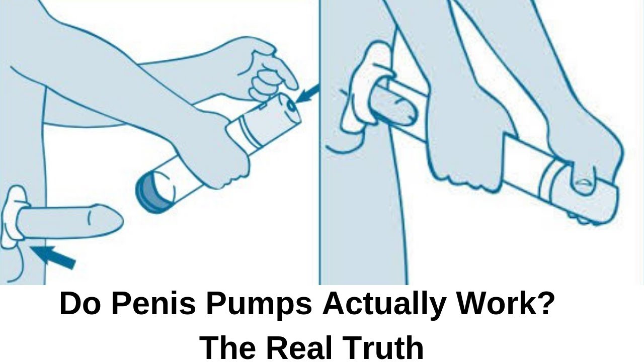 do penis pumps work