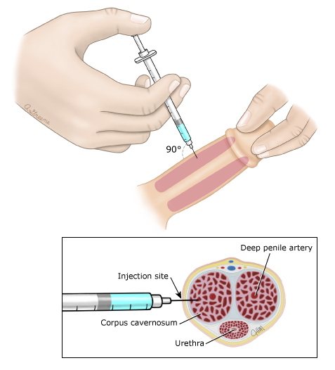 how to increase blood flow to penis