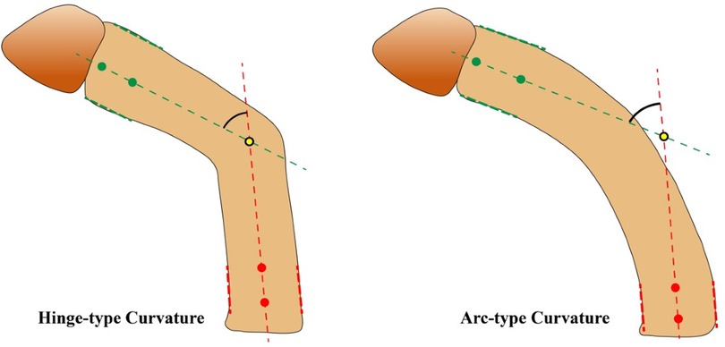 how to measure a curved penis