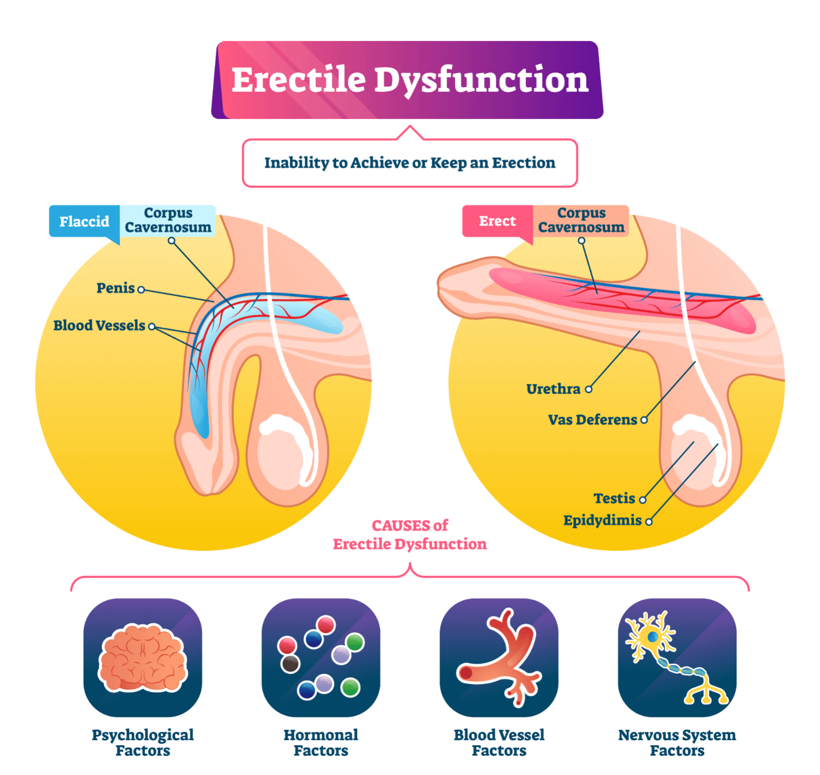 what causes erectile dysfunction