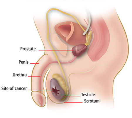 what is a scrotum