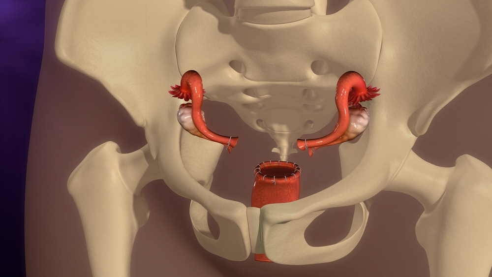 where does sperm go after hysterectomy